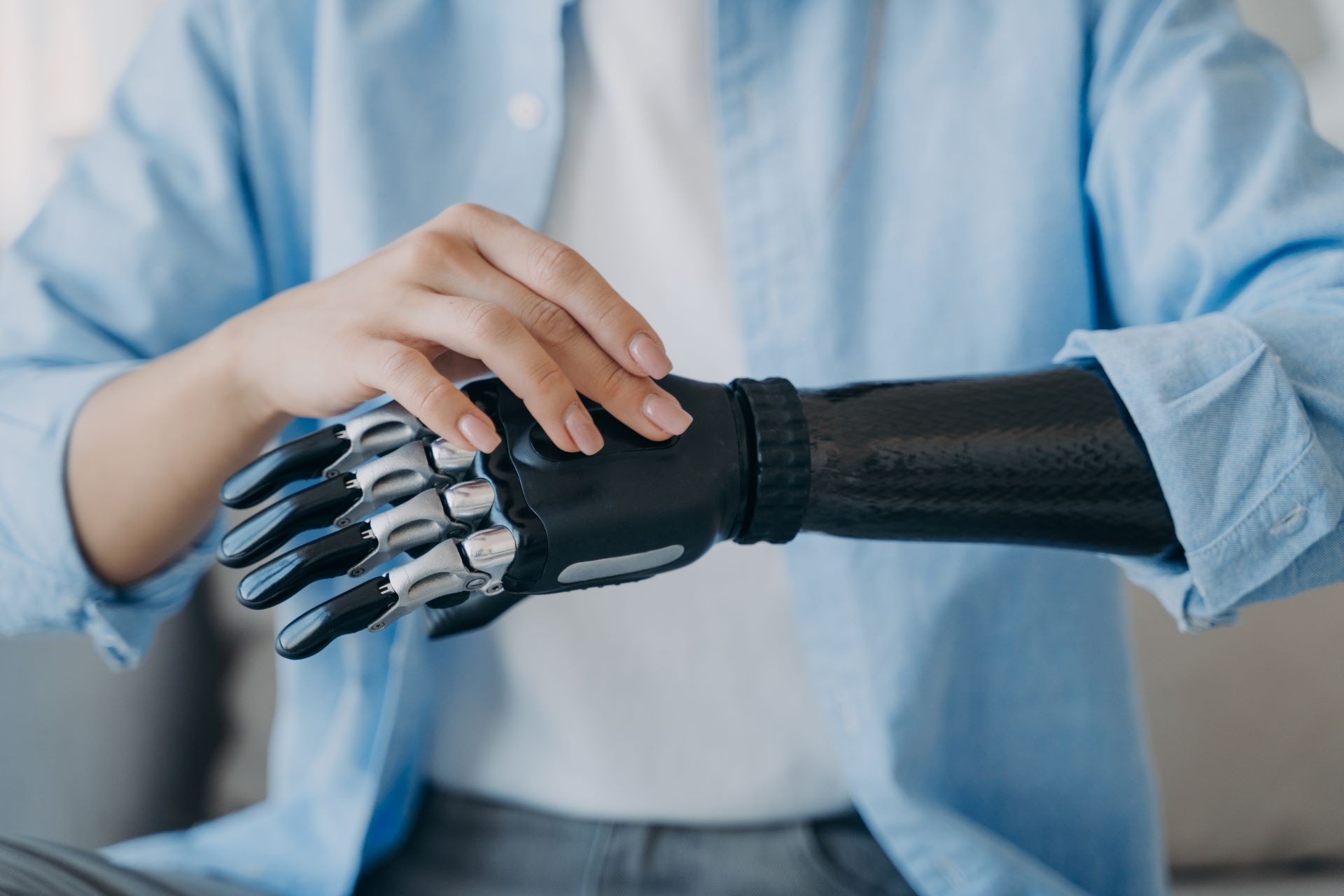 Cure Bionics is developing 3D-printed prosthetic limbs