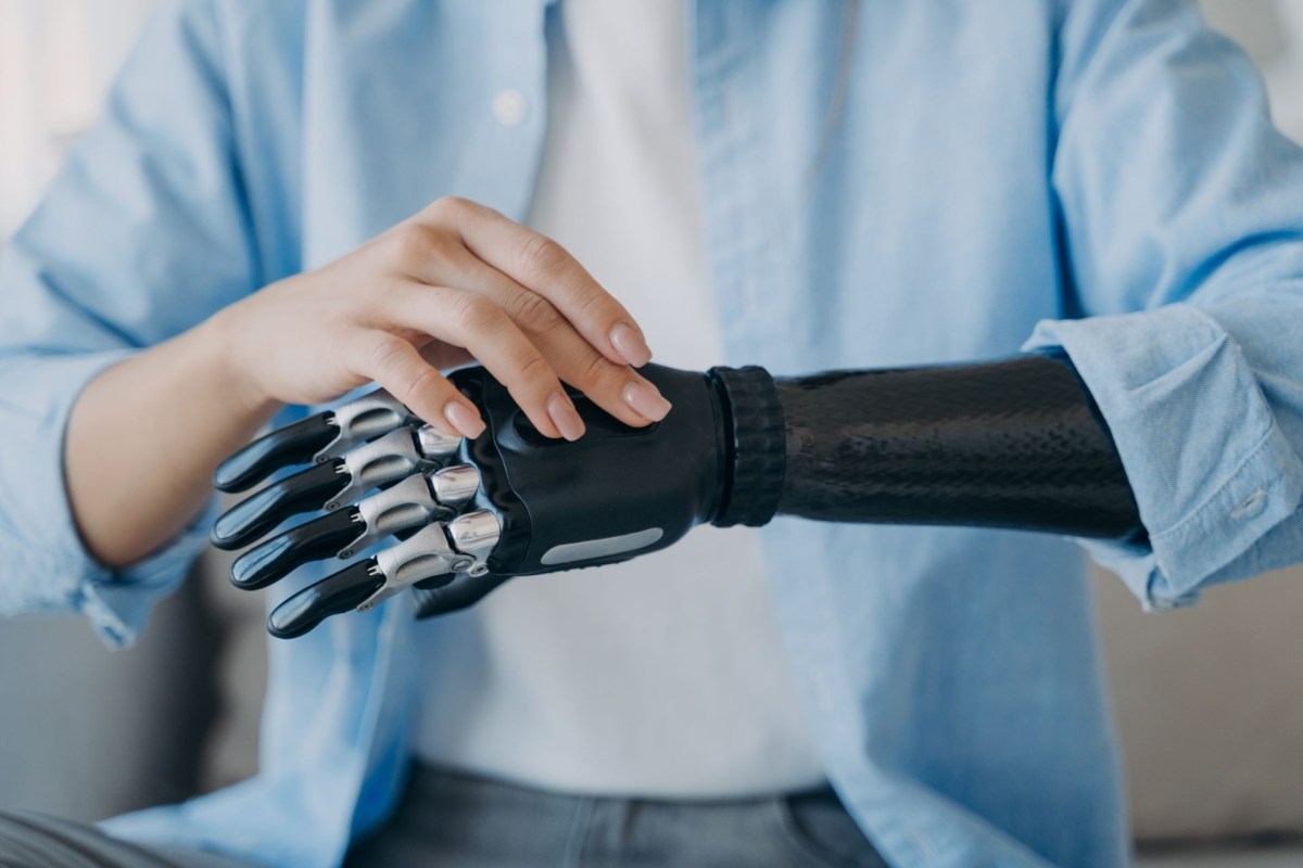 Cure Bionics, 3D-printed prosthetic limbs