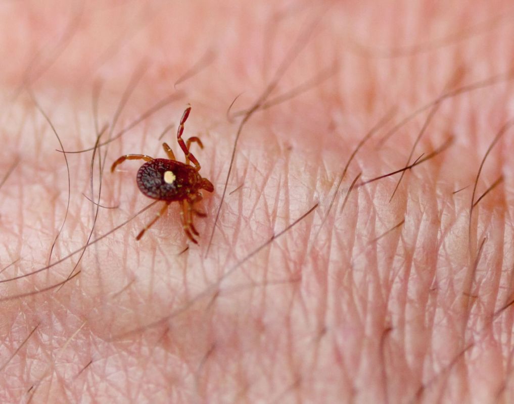 CDC issues warning over life-threatening allergy caused by a single tick bite