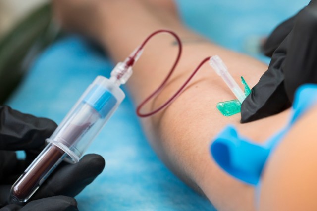 The study "emphasizes the need for methods to reduce ... exposure in humans."