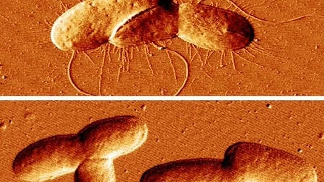 "This study is a testament to the unexpected connections between plant biology and microbiology."