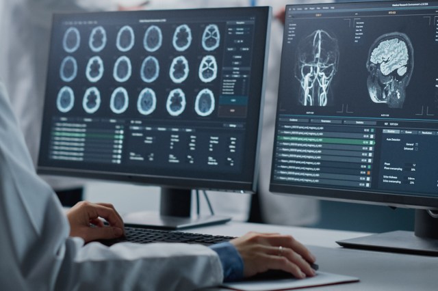 "Directly associated with a lower risk of cognitive decline.”