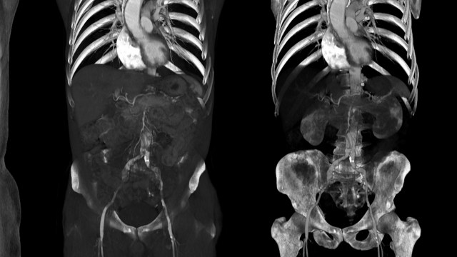 The researchers say there is an increased need for better technology and tissue retrieval banks to help them.