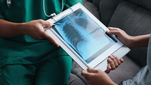 These findings suggest that those with asthma and COPD have a heightened response.
