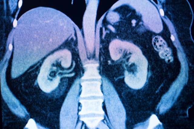 We don't yet know the full extent of the potential risks to human health.