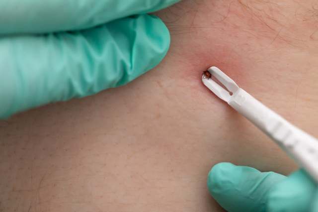 According to the World Health Organization, vector-borne diseases cause more than 700,000 deaths annually.