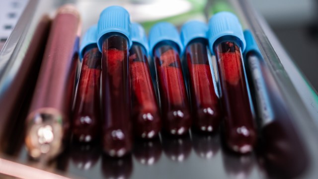 These findings matter for millions of people worldwide.