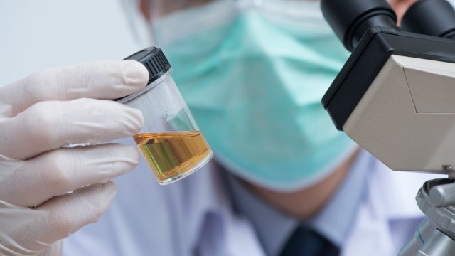 "The odor is very, very strong."