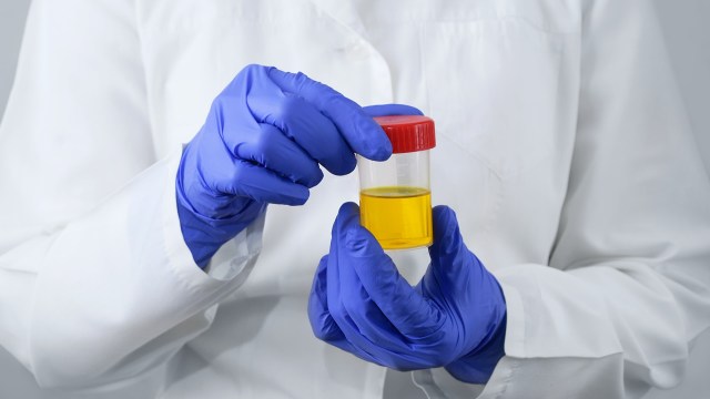 Their discovery is significant.