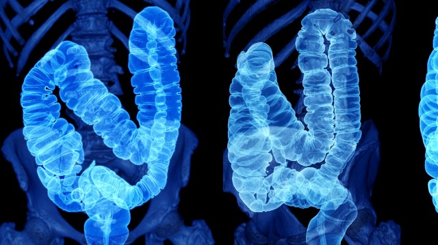 "Sustained investment in this type of research will be critical in the global effort to prevent and treat cancer before it’s too late."