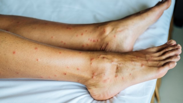 "Once you introduce a species to a new place, anything can really happen."