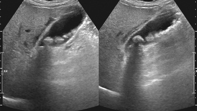 The consequences are mounting.