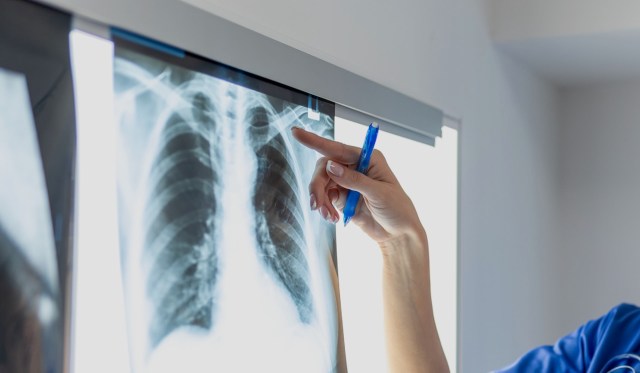 "We also saw an increasing rate of hospitalizations."