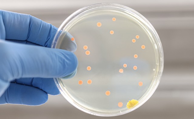 "We need to try and mitigate their impact on our health now."