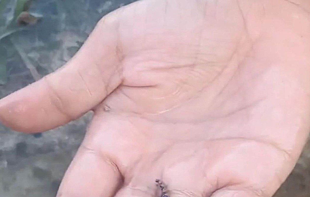 There is no known cure other than waiting out symptoms with treatment and hoping for the best.