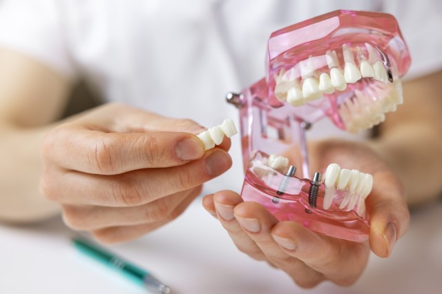 Approximately 45% of the global population faces oral health challenges.
