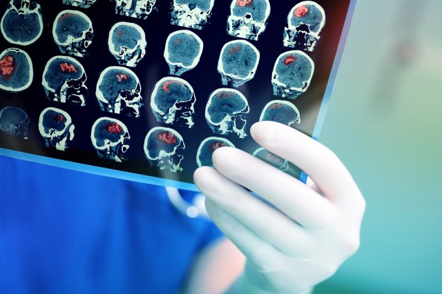 Governments around the world are already taking steps.