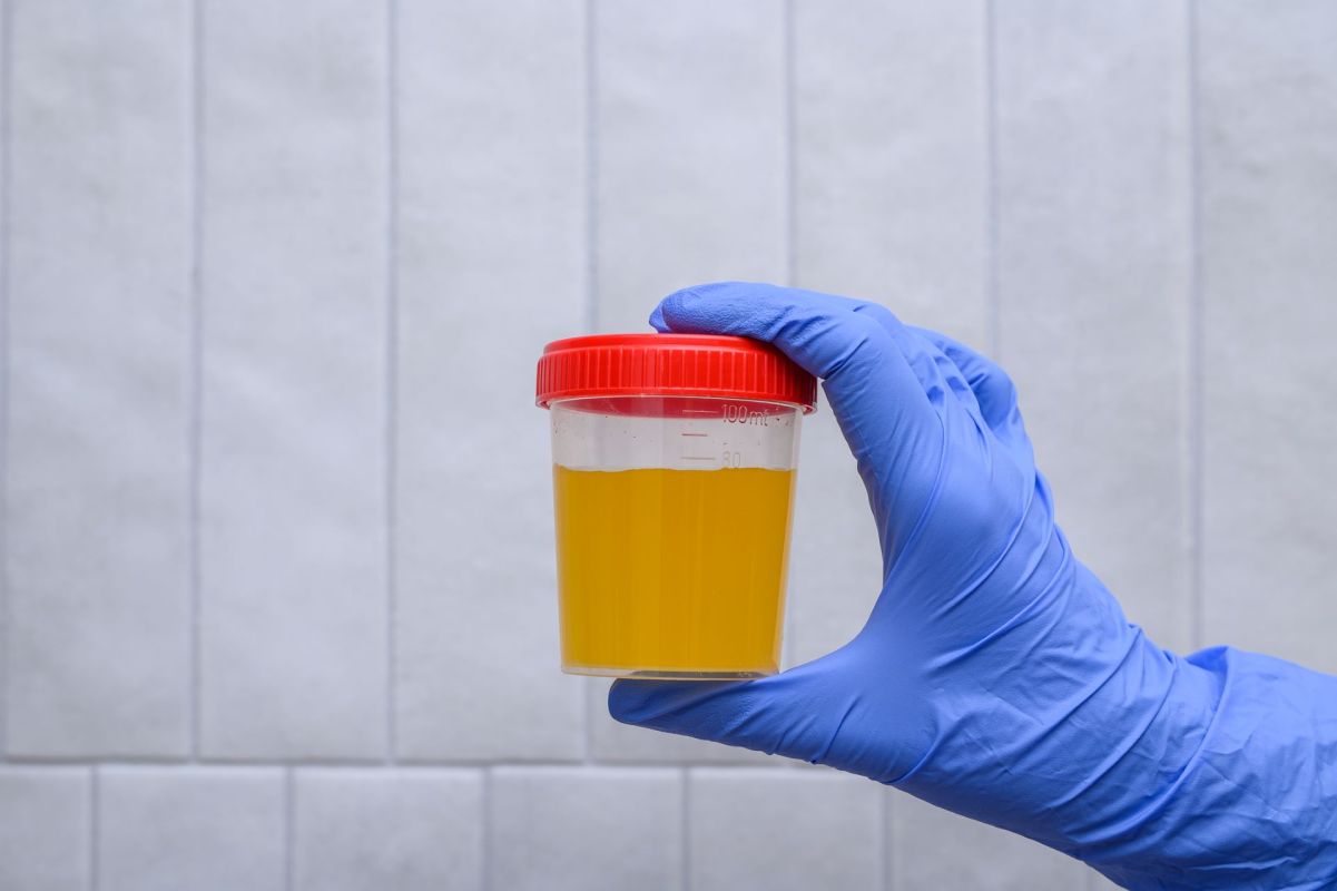 "Think about beer that's made via fermentation processes."