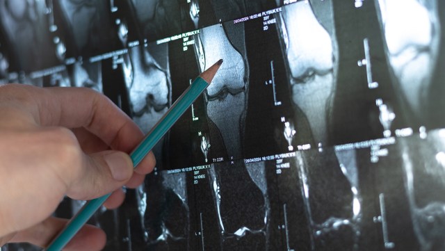 "We already know that practices such as physical exercise, a balanced diet, and pharmacological treatments contribute significantly to this."