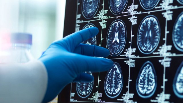 There’s no escaping it, but the full extent of its impact on human health isn’t entirely understood.