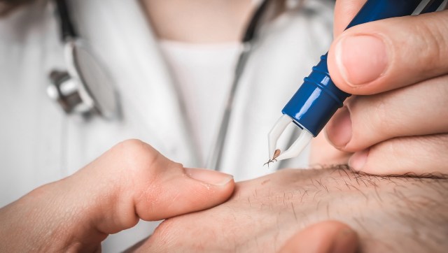 Nonstandard tests and treatments for Lyme disease are on the rise, which could have devastating consequences for patients.