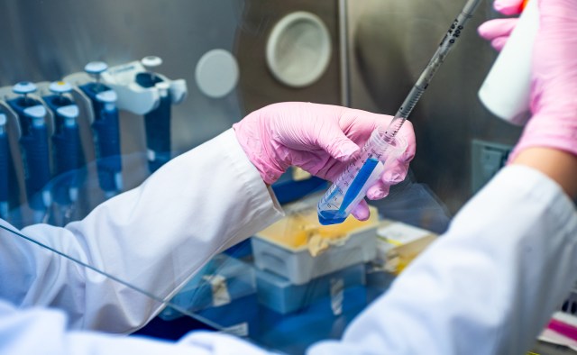 For the study, scientists analyzed 32 tissue samples.