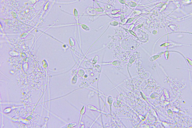 Former tech entrepreneur Bryan Johnson claimed a bizarre victory over microplastics in his body.