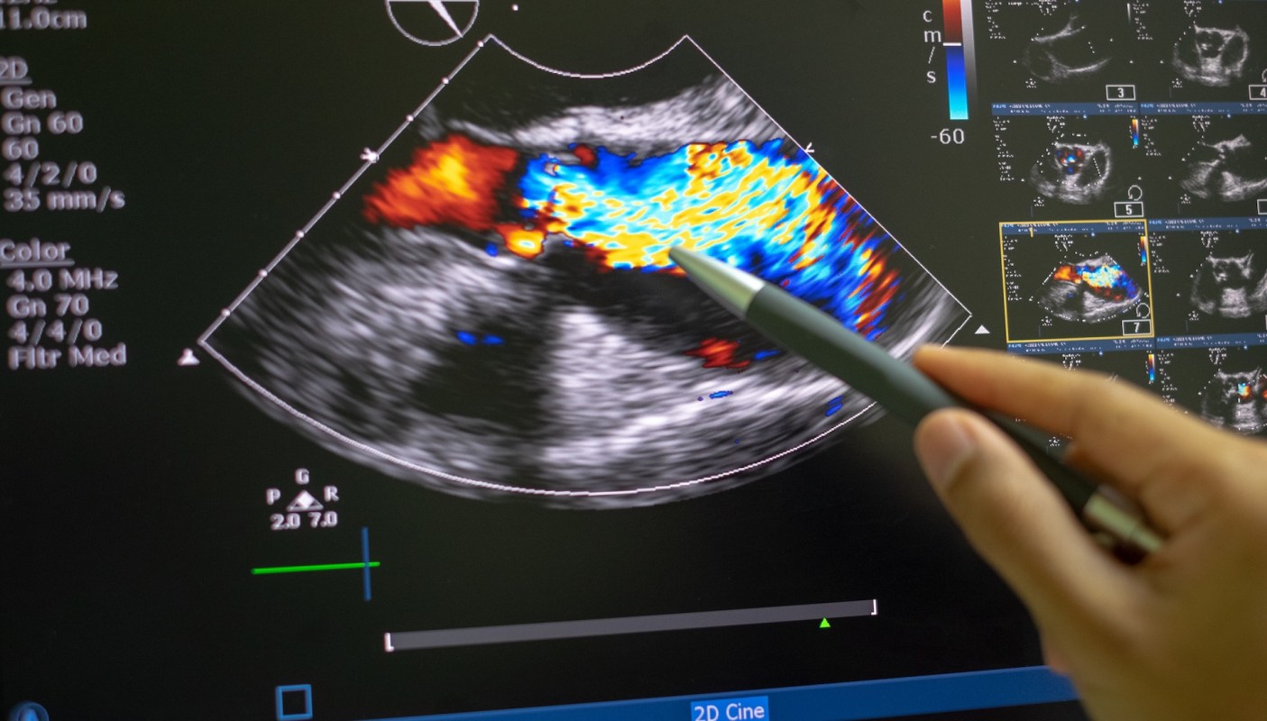 Environmental factors such as air pollution, extreme temperatures, and exposure to harmful chemicals could be responsible for around one in five cardiovascular deaths in the European Union.