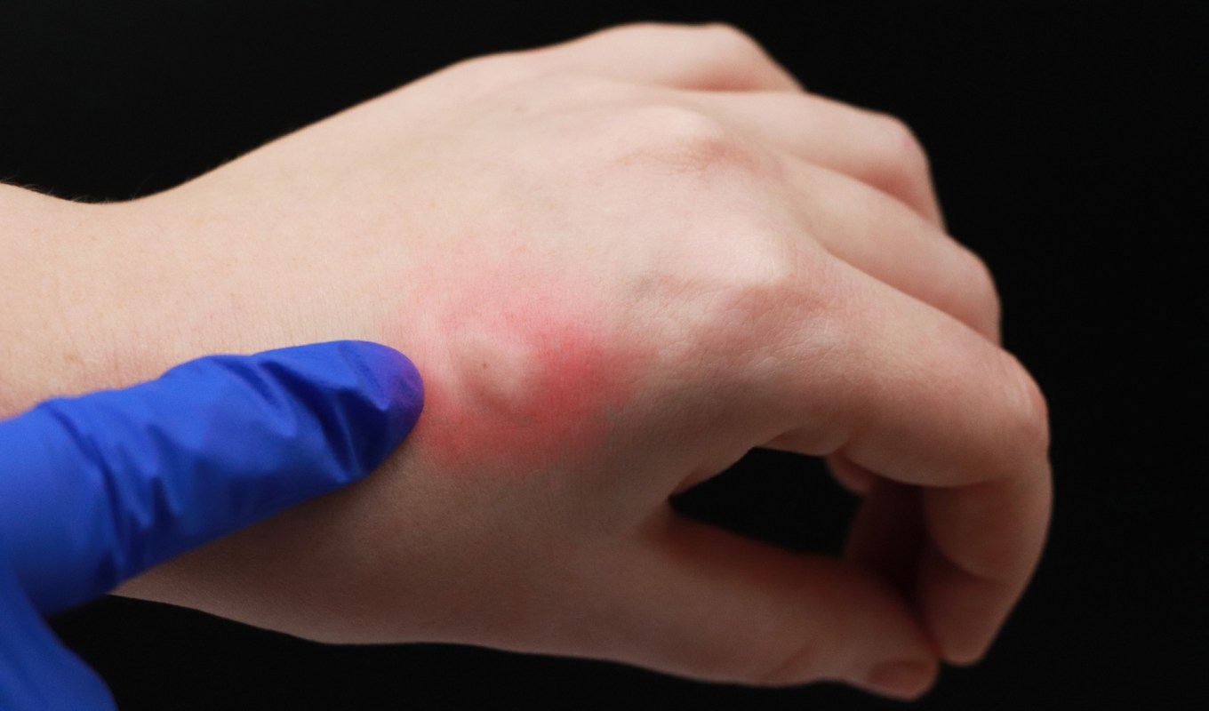 California has confirmed new sightings of the invasive Aedes aegypti mosquito that can spread multiple viral diseases.