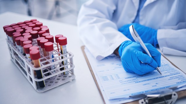 Researchers found high levels of ultrashort-chain PFAS in blood samples taken from Wilmington's residents between 2010 and 2016.