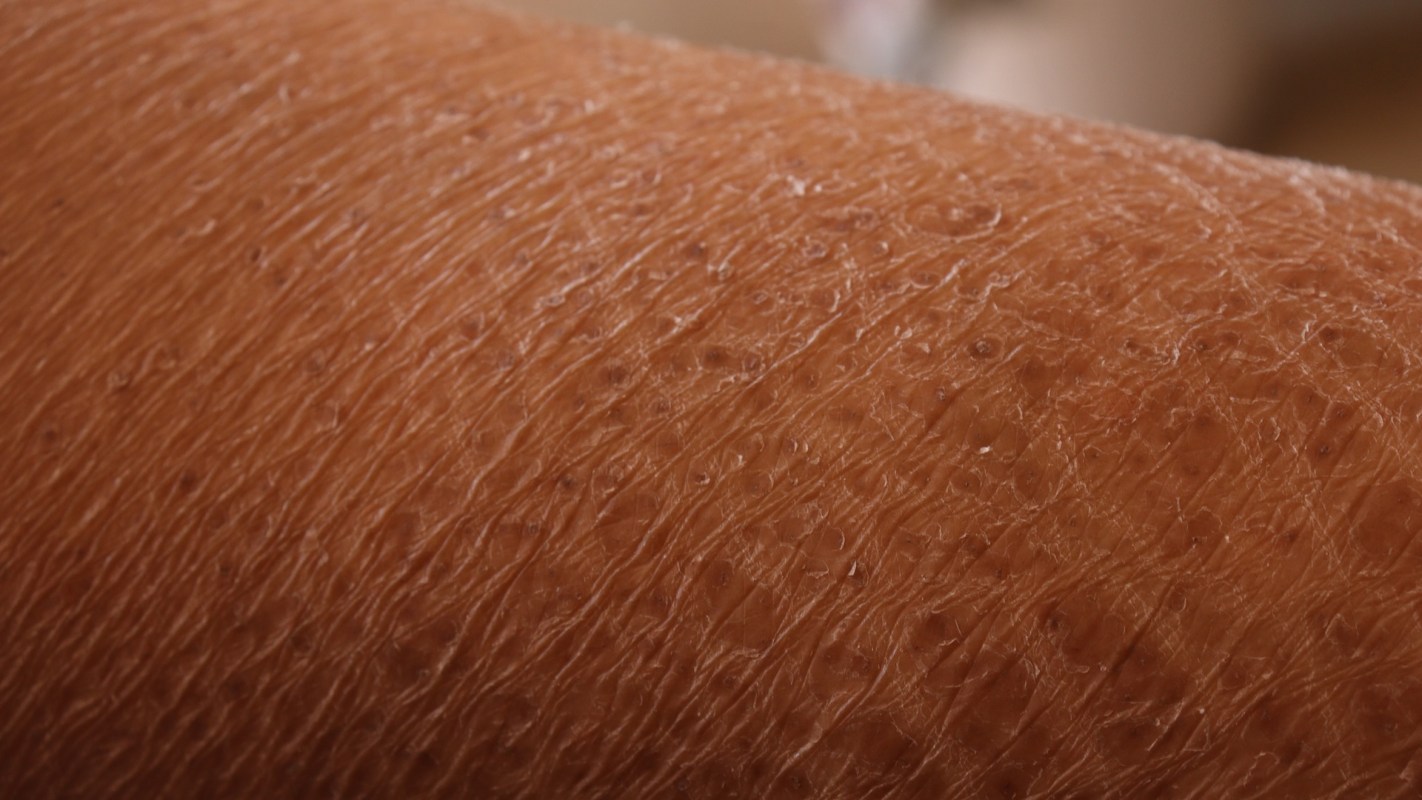 Scientists discovered that nanoplastic pollution can be absorbed through your skin, raising concerns for human health.