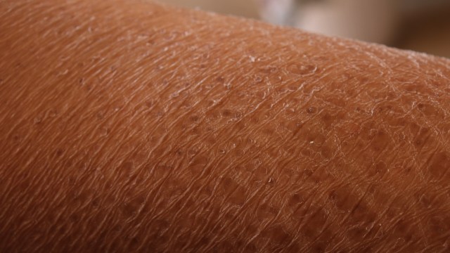Scientists discovered that nanoplastic pollution can be absorbed through your skin, raising concerns for human health.