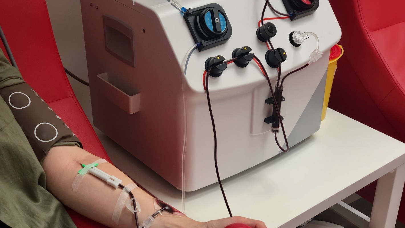 Apheresis has shown potential as a method for filtering microplastics, but it's incredibly costly for this treatment.