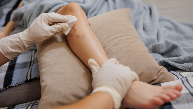 Australians have been experiencing an uptick of a serious mosquito-borne virus, according to ABC.