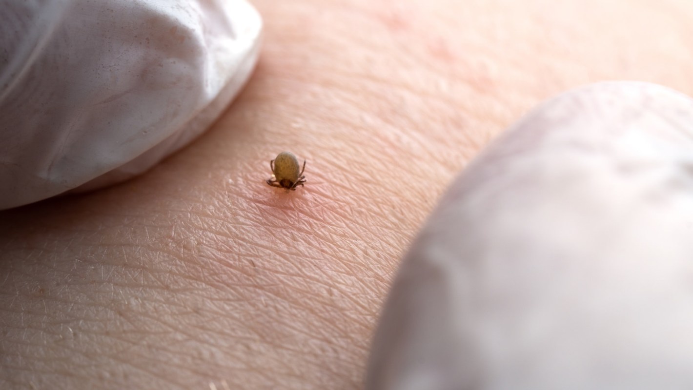 Two women spent months seeking answers for symptoms doctors could not explain. It turned out that ticks were to blame.