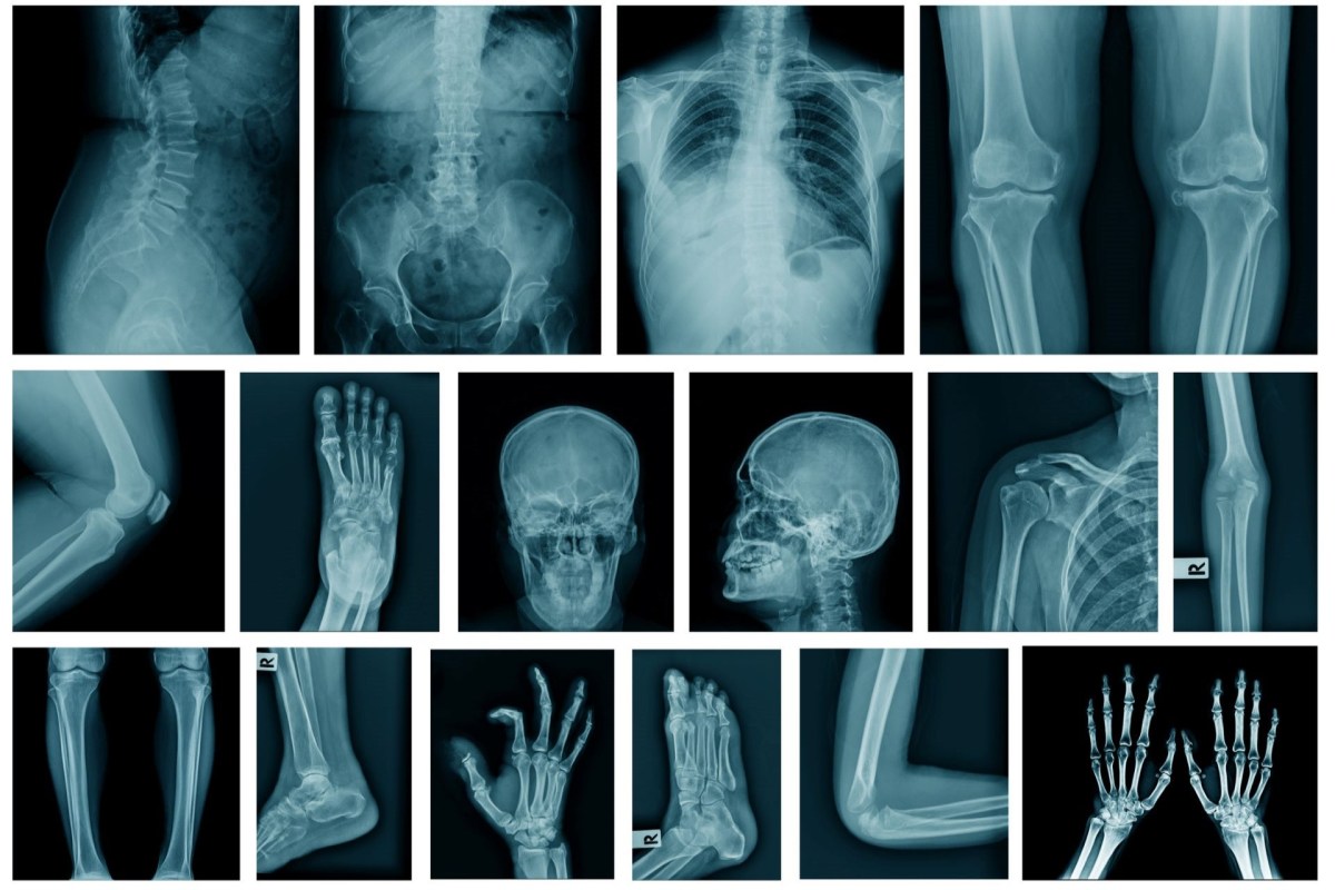 Two researchers argue that humans are suffering from an evolutionary mismatch, leading to chronic stress and other health issues.