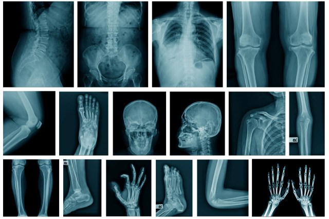Two researchers argue that humans are suffering from an evolutionary mismatch, leading to chronic stress and other health issues.