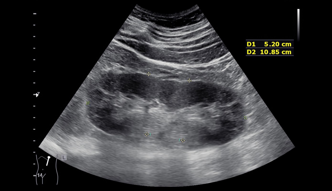 Endocrine disruptors are often hiding in plain sight. A researcher is shedding light on the surprising everyday items filled with these dangerous chemicals.
