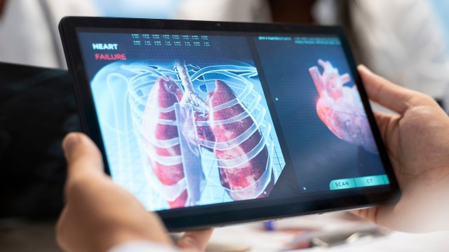 A new AI model is being used to help diagnose tuberculosis, one of the world's deadliest diseases.