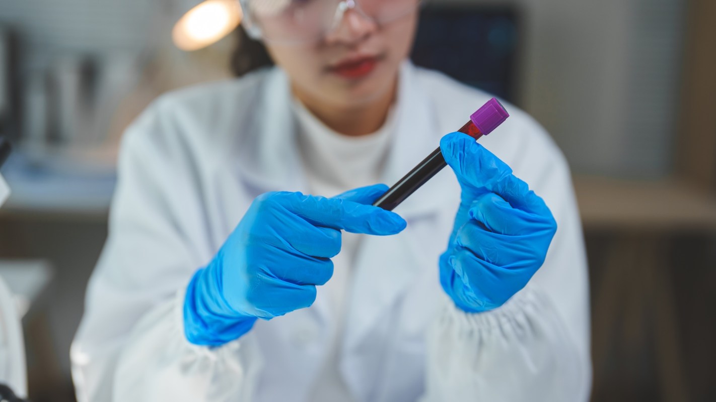 One woman's alarming at-home test revealed high levels of microplastics, prompting a call to action for more research and better regulation.