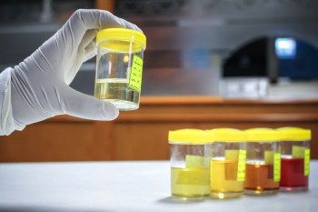 Researchers took a closer look at tiny particles shed from car tires and the toxic chemicals that they can release over time.