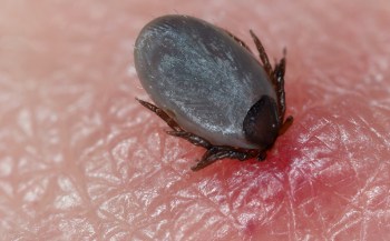 Anaplasmosis, a serious tick-borne illness, is rapidly spreading in parts of the U.S., with cases ballooning in Pennsylvania.