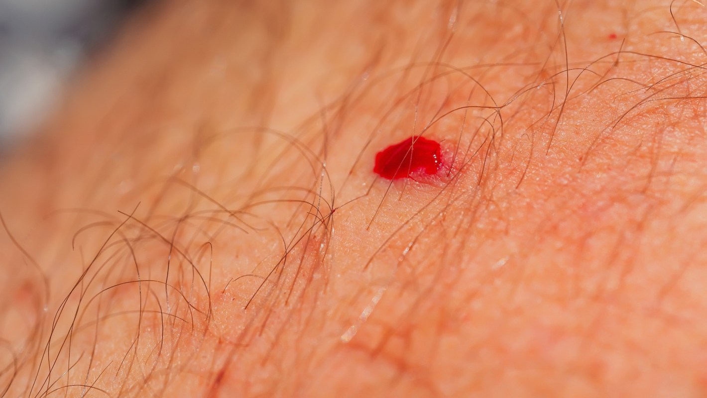 New research has found that mosquitoes are increasingly turning to humans to find their next meal.