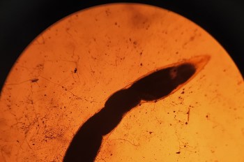 Rat lungworm has been detected in animals in San Diego County, California, an area previously outside its range.