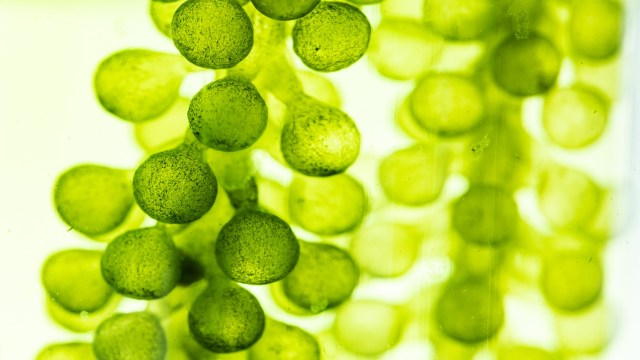 Algae cells under microscope.
