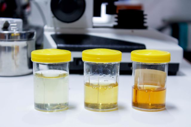 Testing of urine vials in lab.