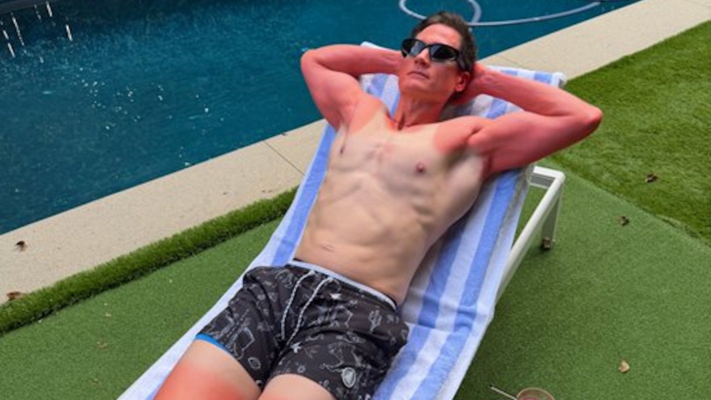 A muscular man in sunglasses relaxes on a lounger by a pool surrounded by artificial turf, displaying sunburn on his arms.