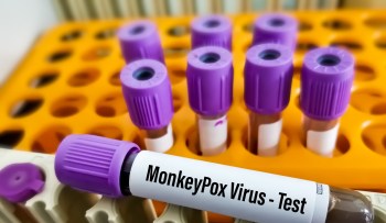 Test tubes with purple caps are arranged in a rack, featuring a labeled tube for monkeypox virus testing.