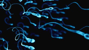 A digitally rendered image of multiple sperm cells swimming against a dark background.