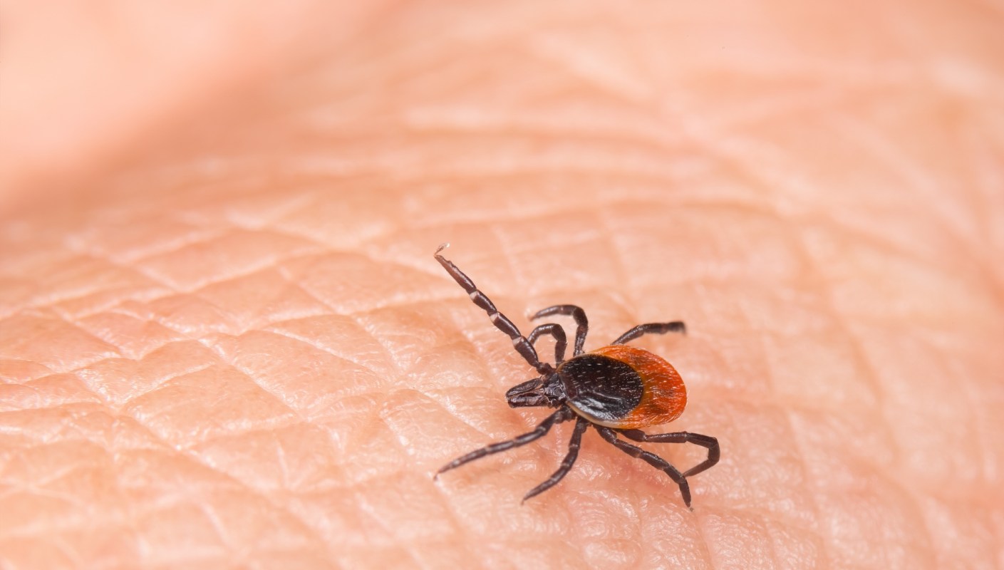 A close-up view of a tick on human skin showing its distinct black and orange body.